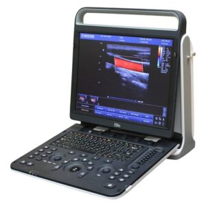 Chison EBit 60