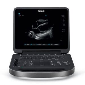 Sonosite Edge II