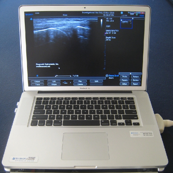 Terason t3200