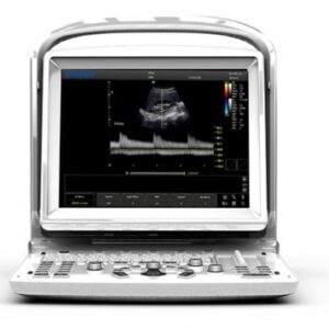 Chison ECO 3