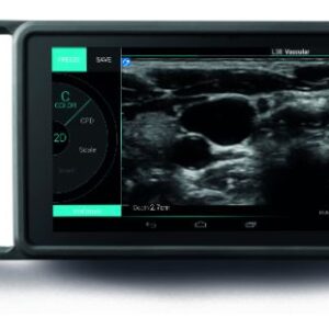 Sonosite iVIZ