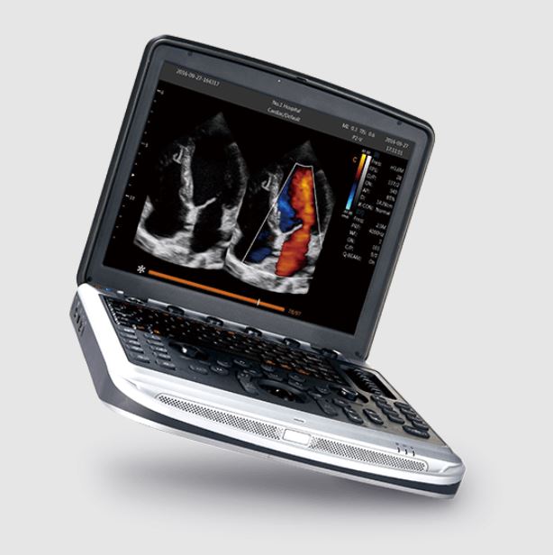 Chison SonoBook 8
